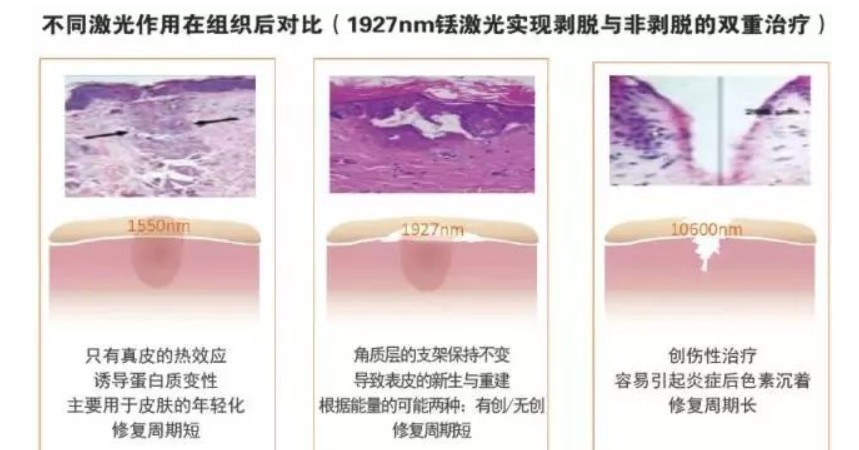 濾光片的作用